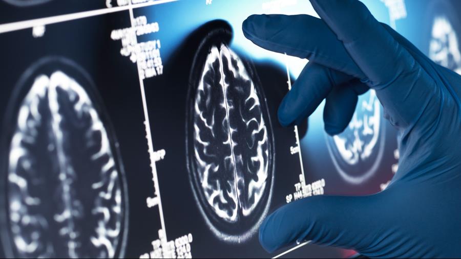 Nieuwe strategie om enzymfunctie bij Parkinson te herstellen