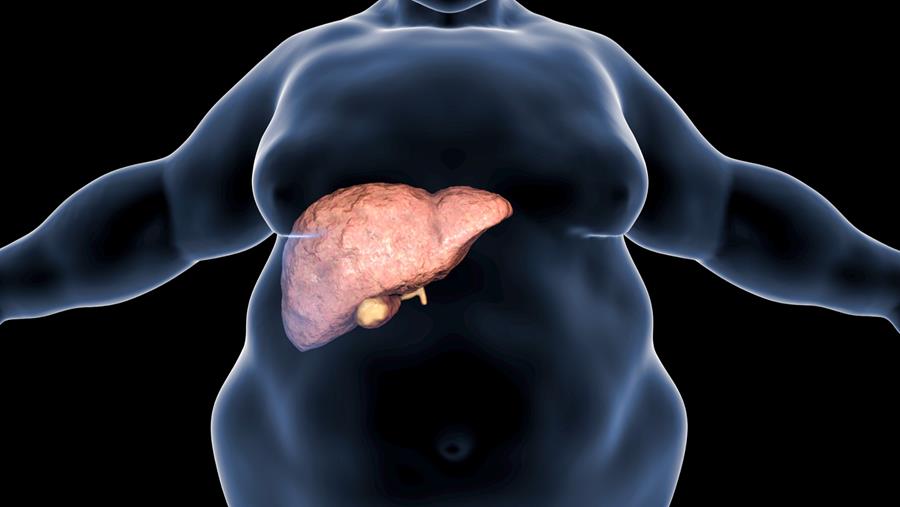 Intermitterend vasten twee dagen op de zeven veelbelovend bij MASH
