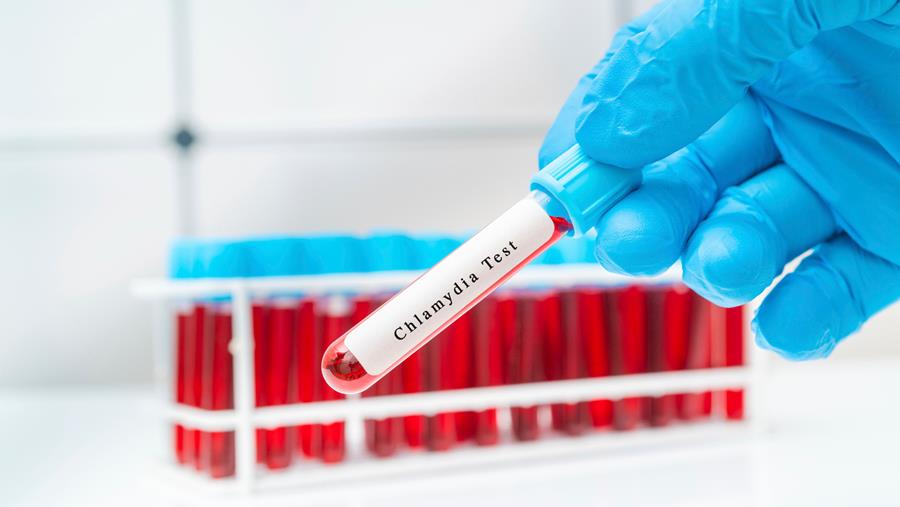 Malgré son efficacité, la doxyPEP reste boudée par les personnes vivant avec le VIH